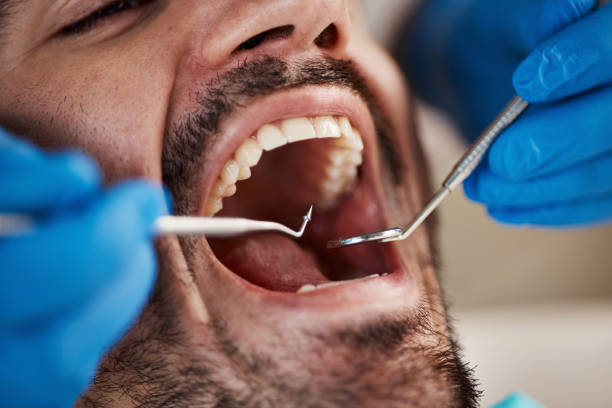 Best Emergency Dental Care for Trauma or Injury in Youngwood, PA